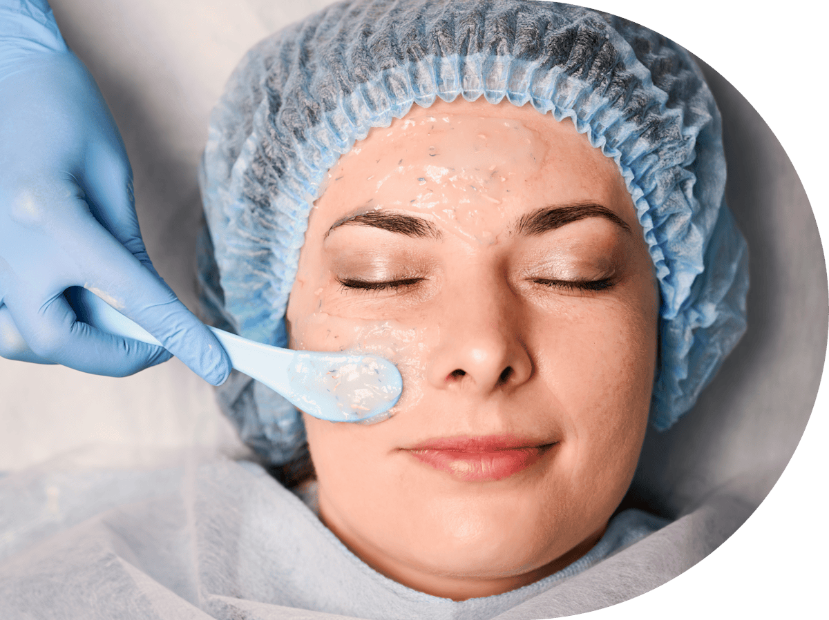 Obagi Blue Peel being performed