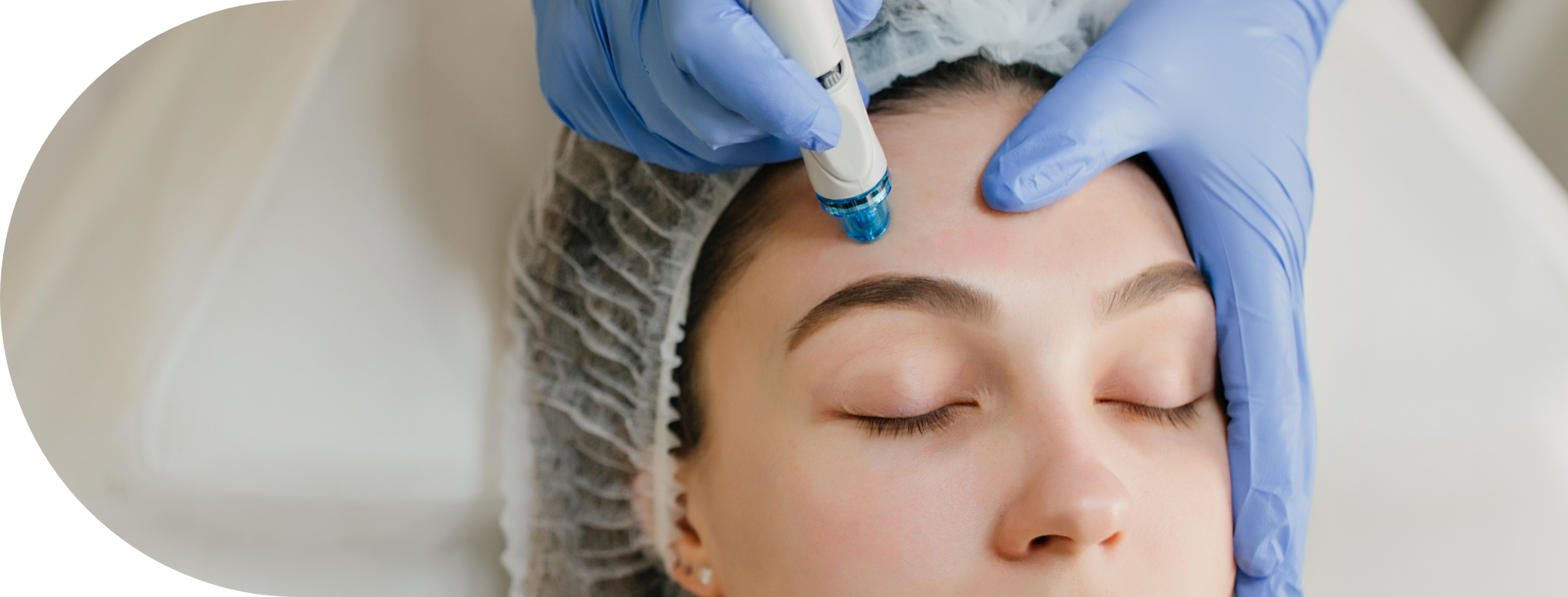 Woman having micro needling treatment