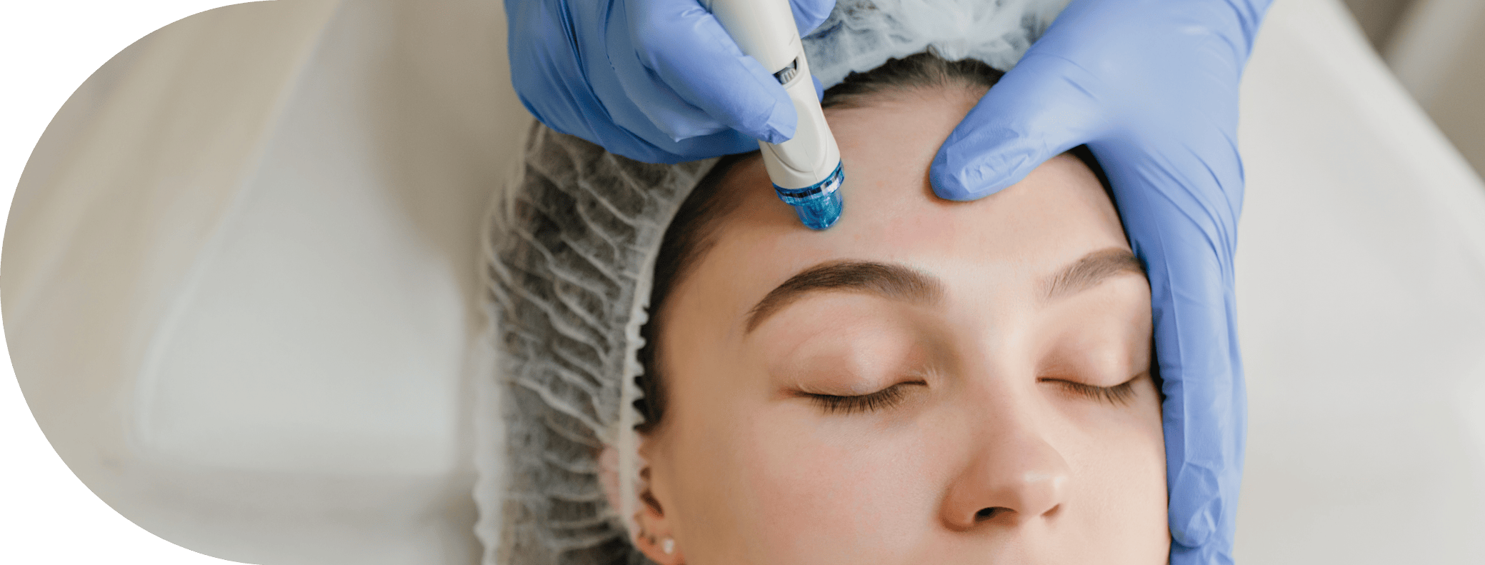 Woman having micro needling treatment
