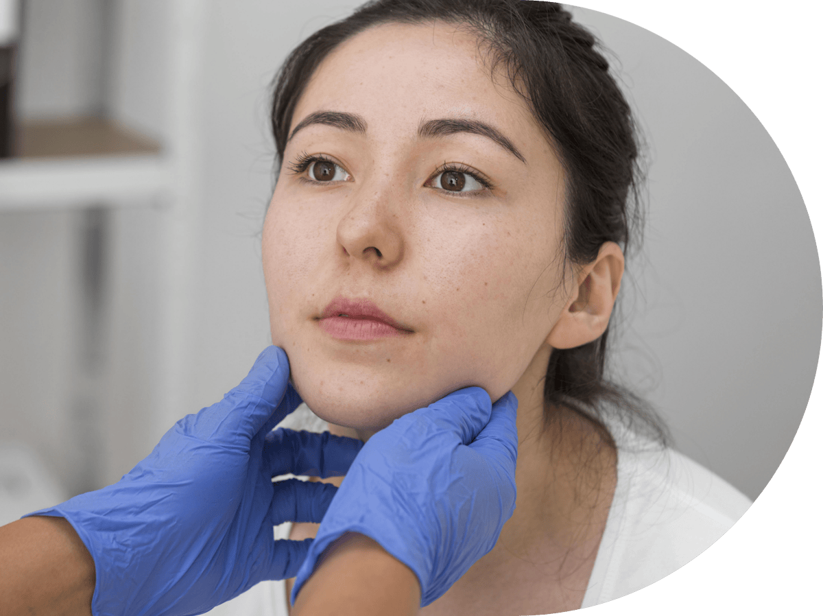 Woman having results review after micro needling treatment on her cheeks