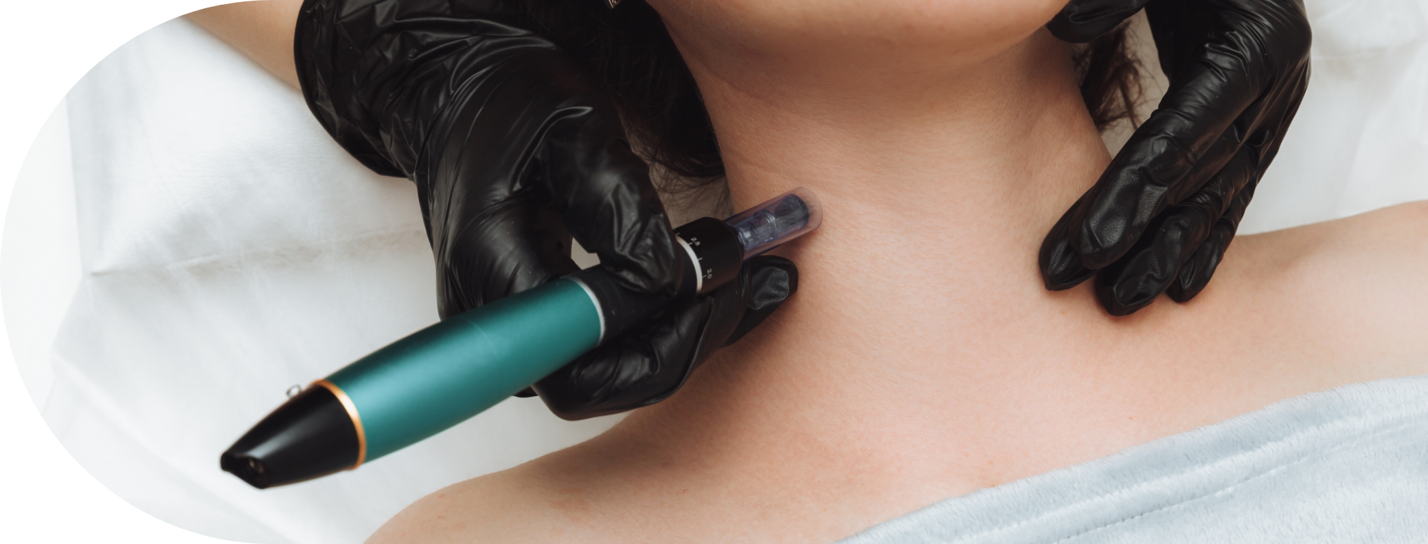 woman having micro needling treatment on her neck