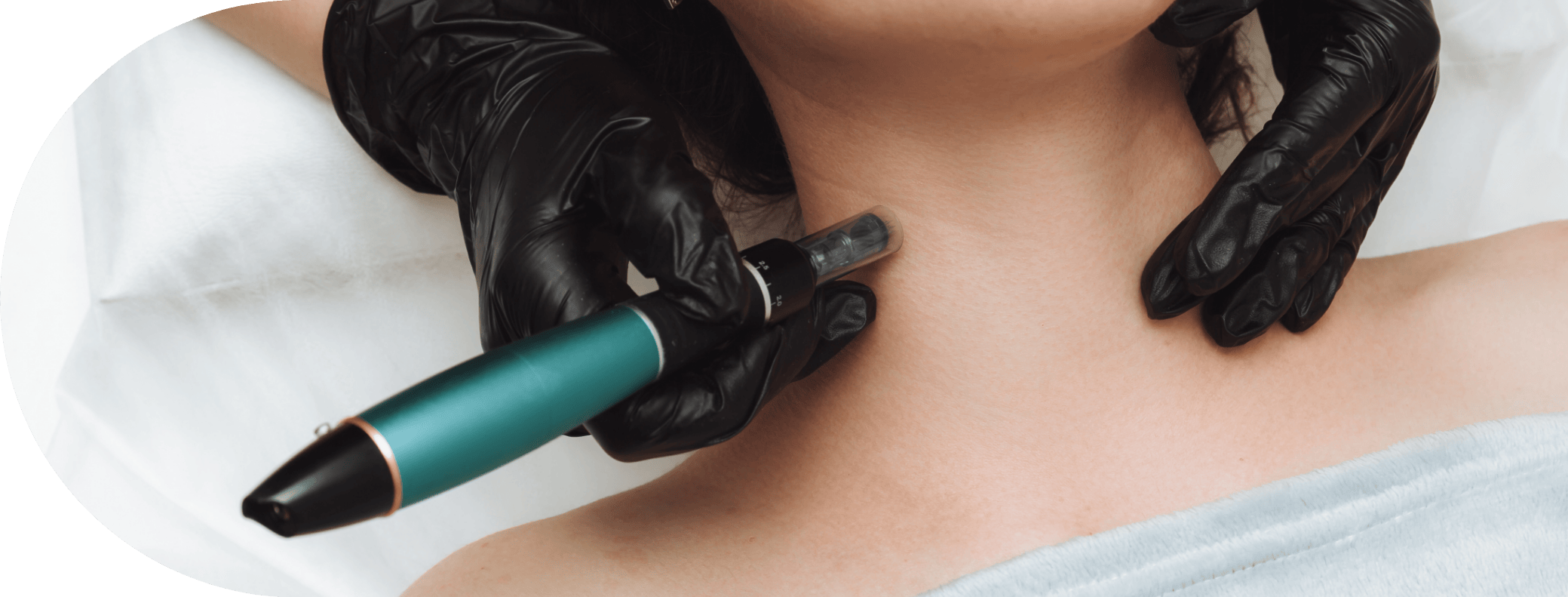 woman having micro needling treatment on her neck