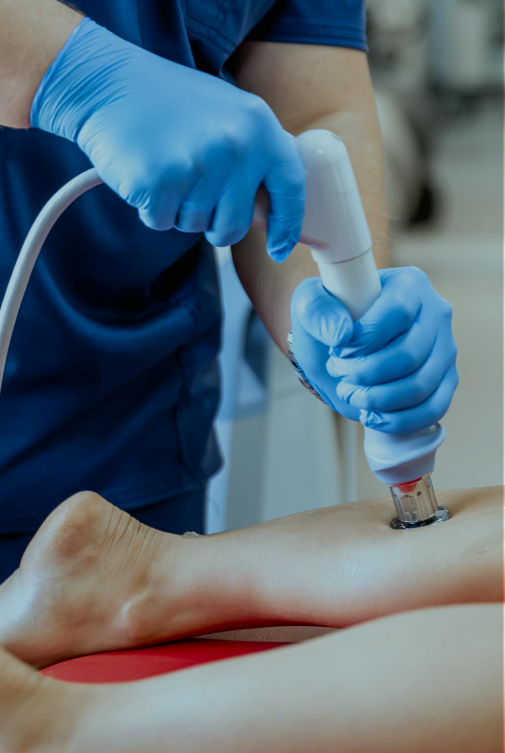 Patient having thread vein removal treatment