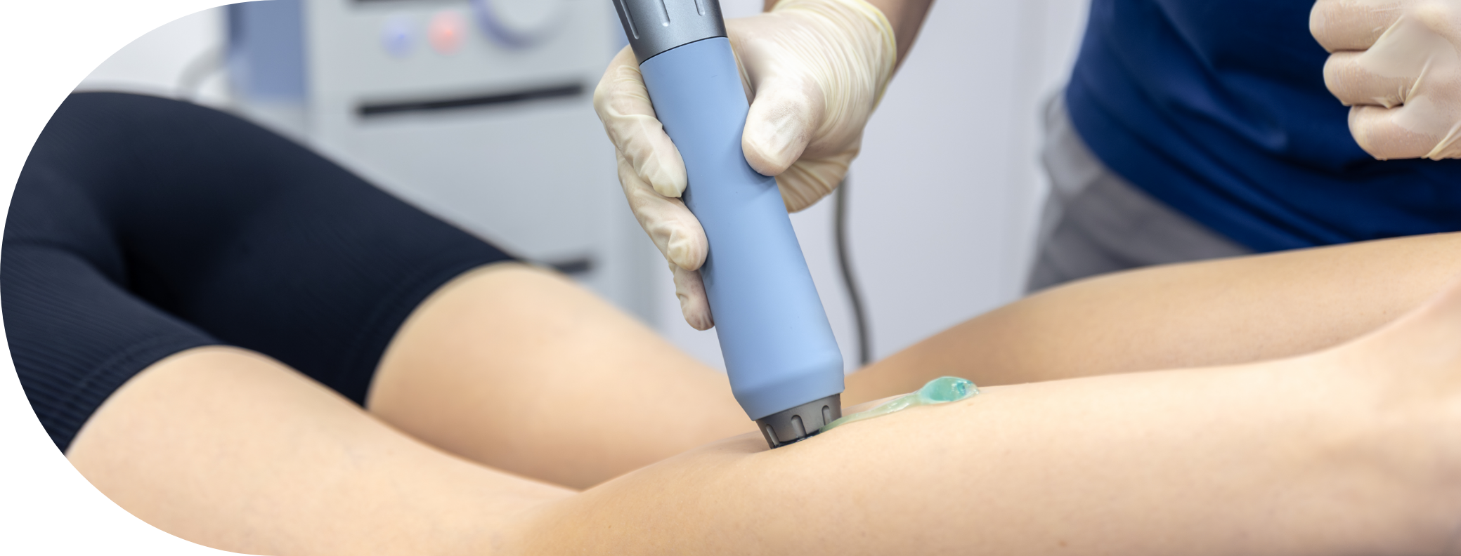 Patient having micro needling treatment