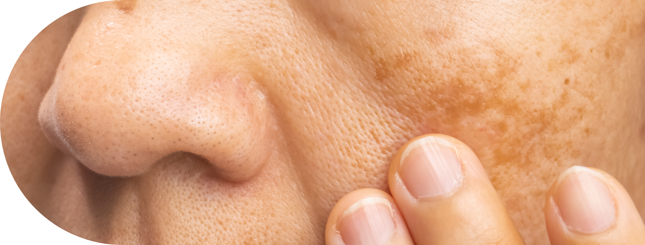 womans face with age spots