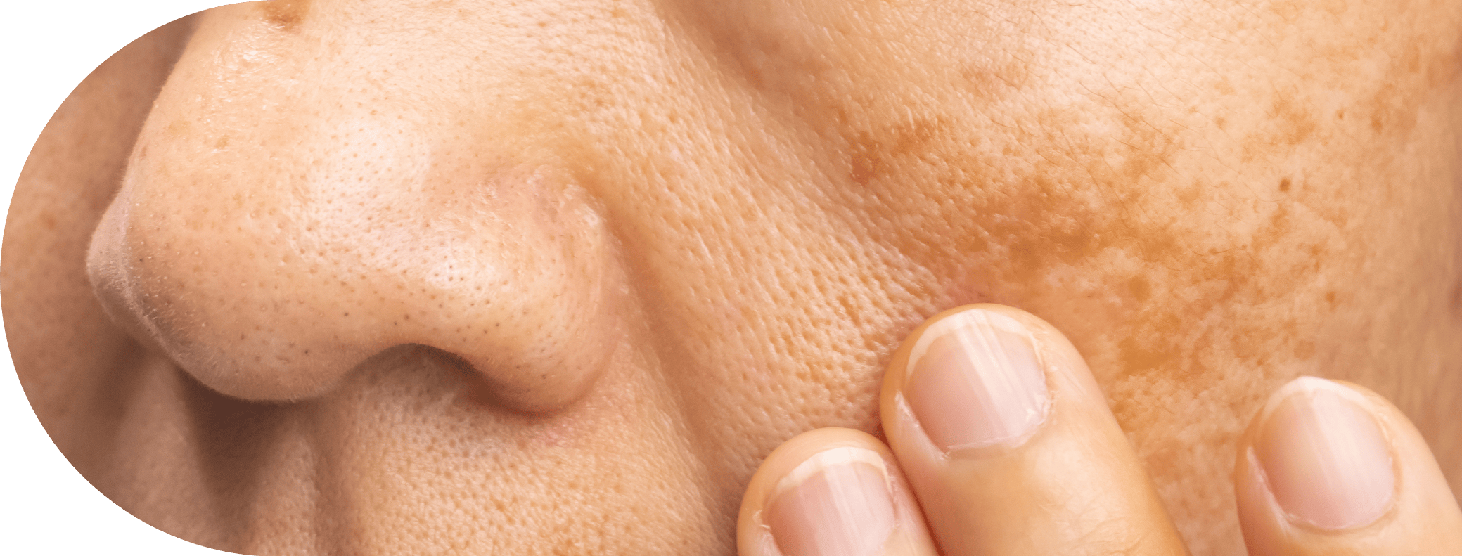 womans face with age spots