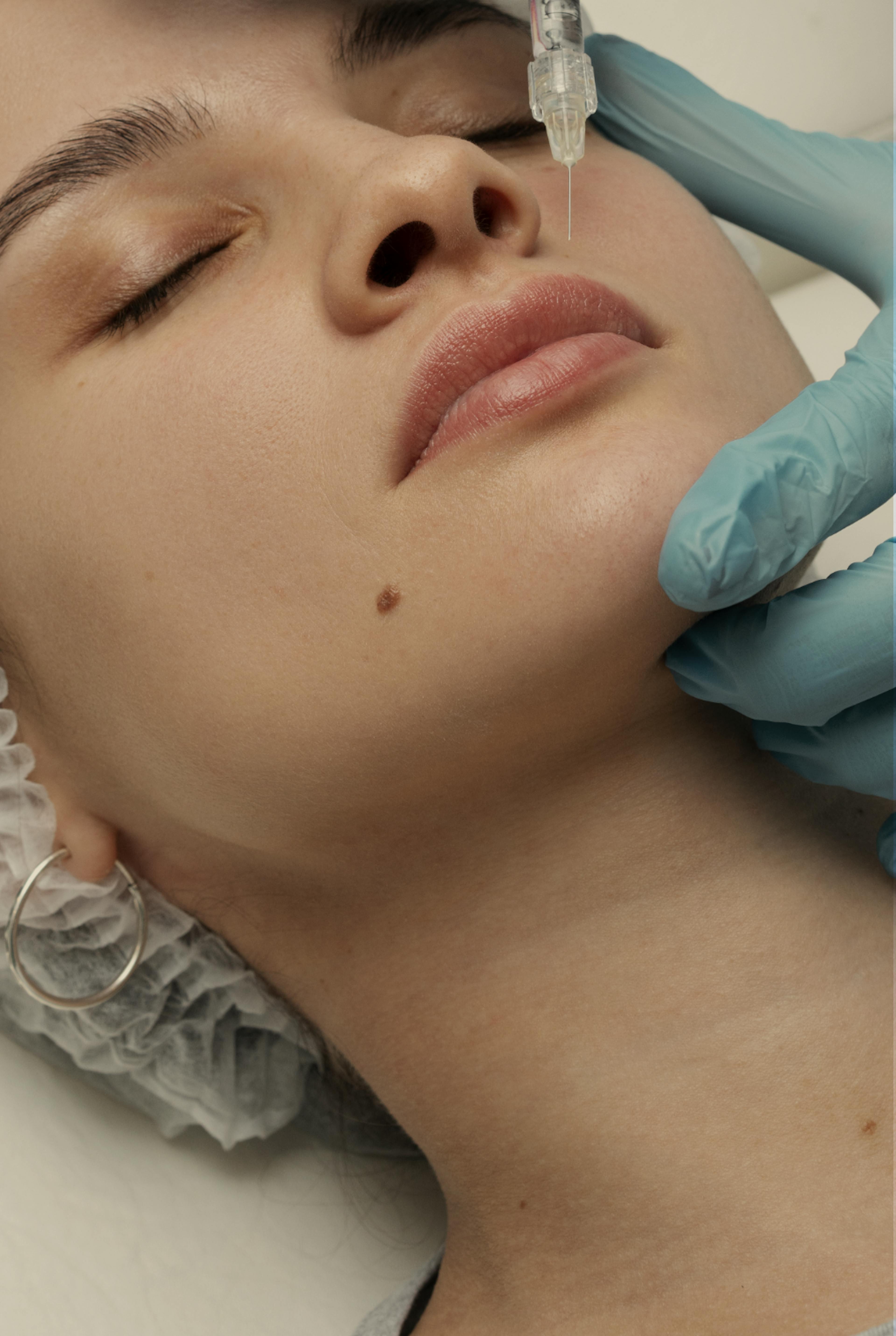 woman having lip filler treatment