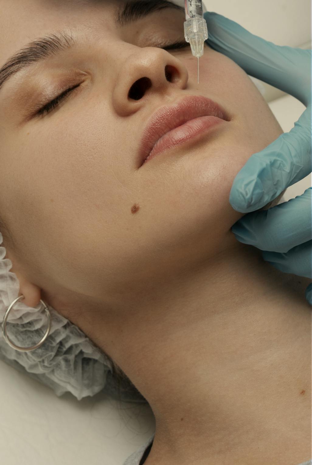 woman having lip filler treatment