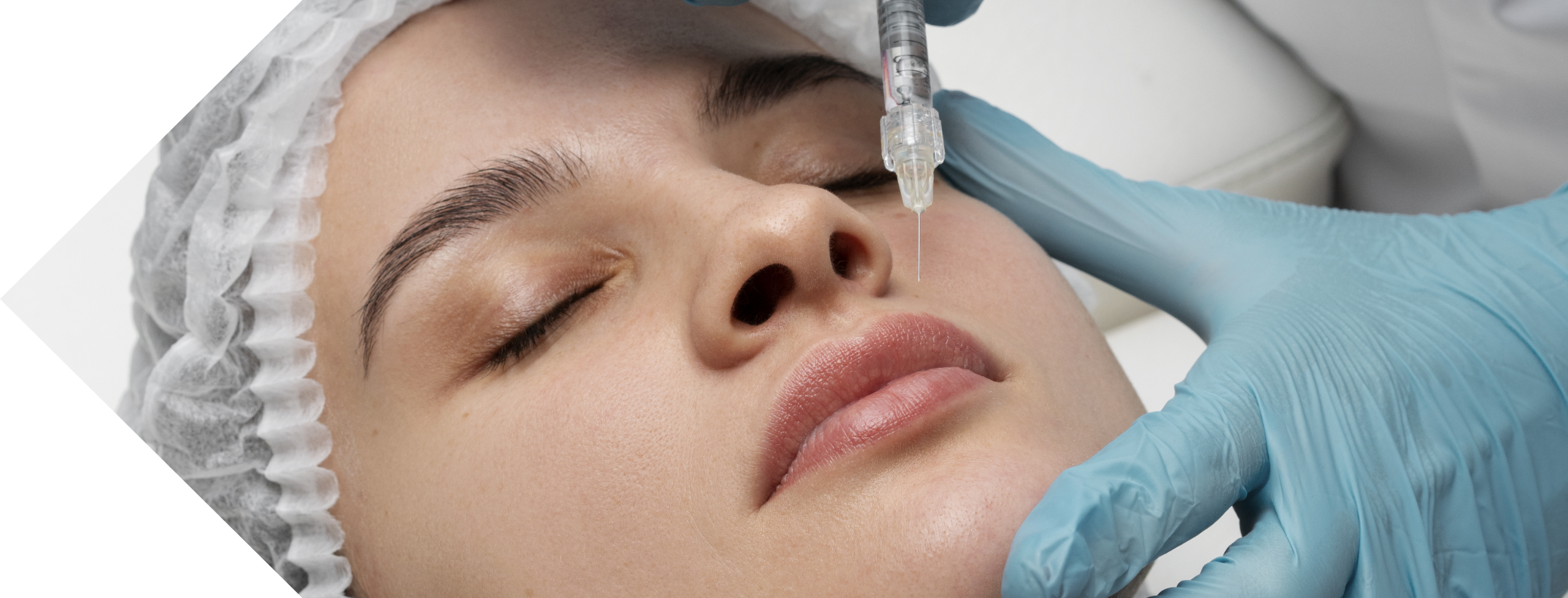 woman having lip filler treatment