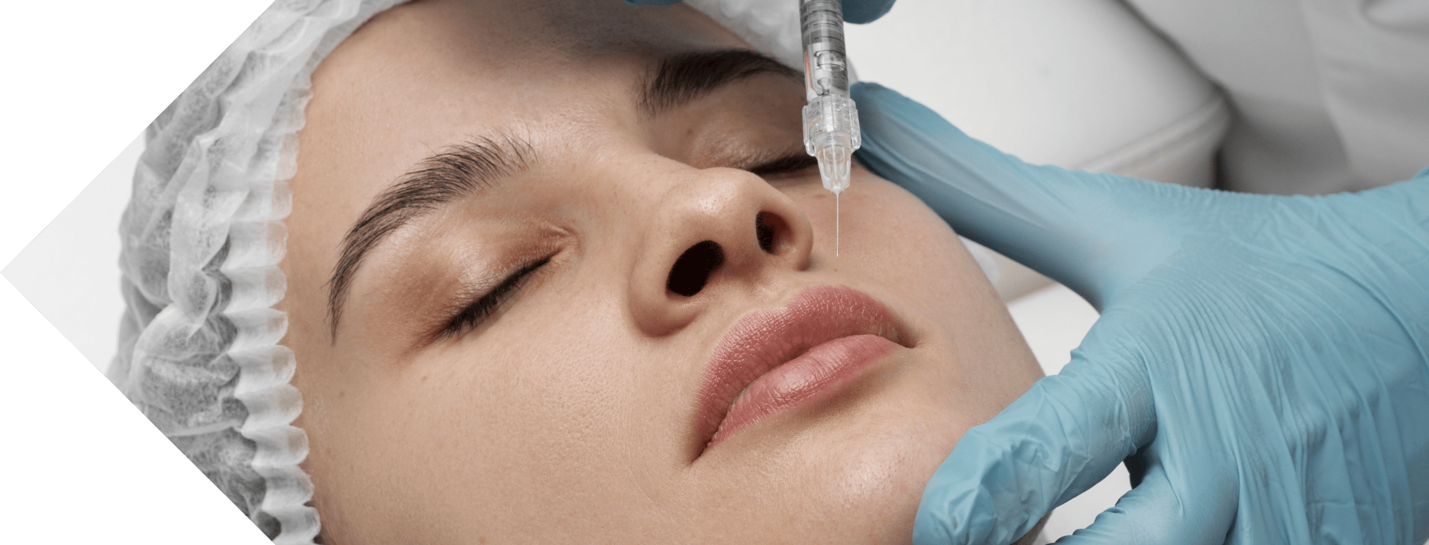 woman having lip filler treatment