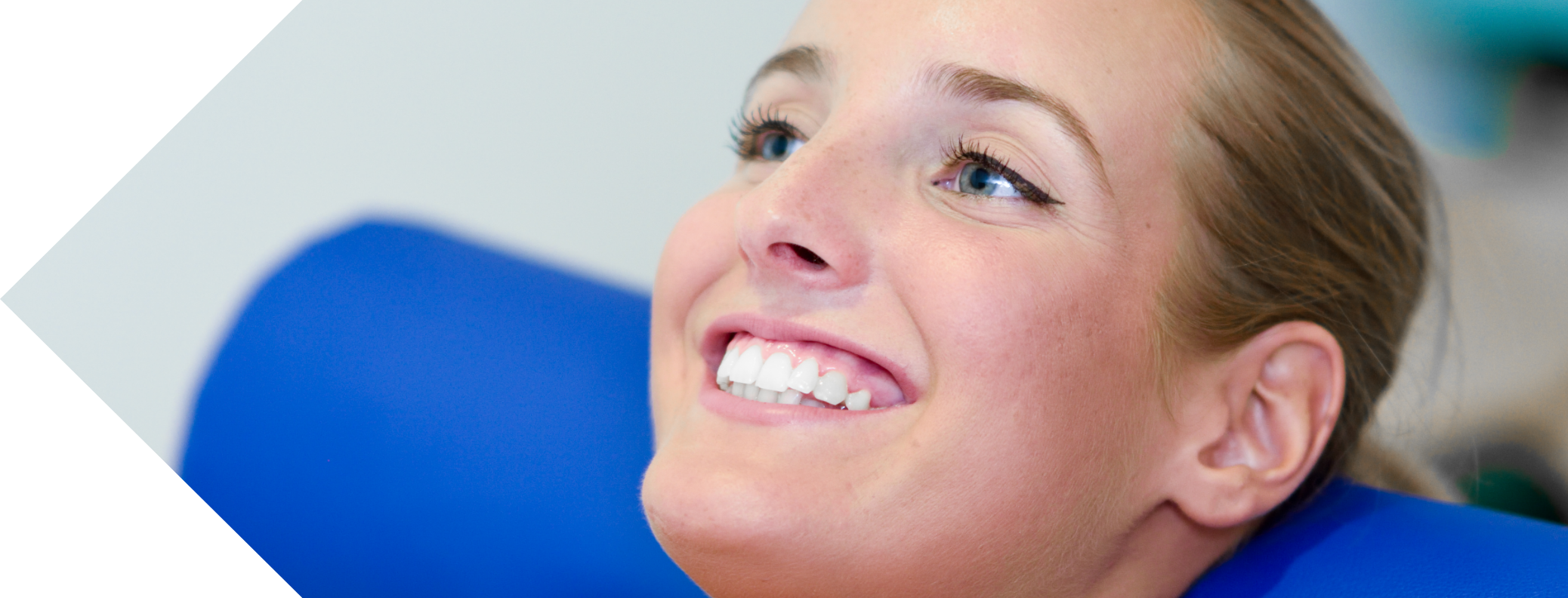 woman having her gummy smile examined