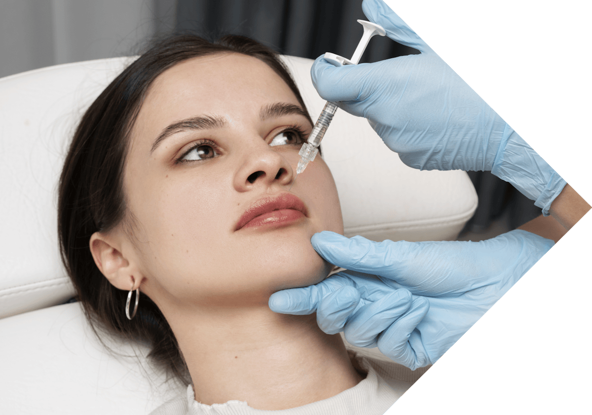 bunny lines treatment being performed