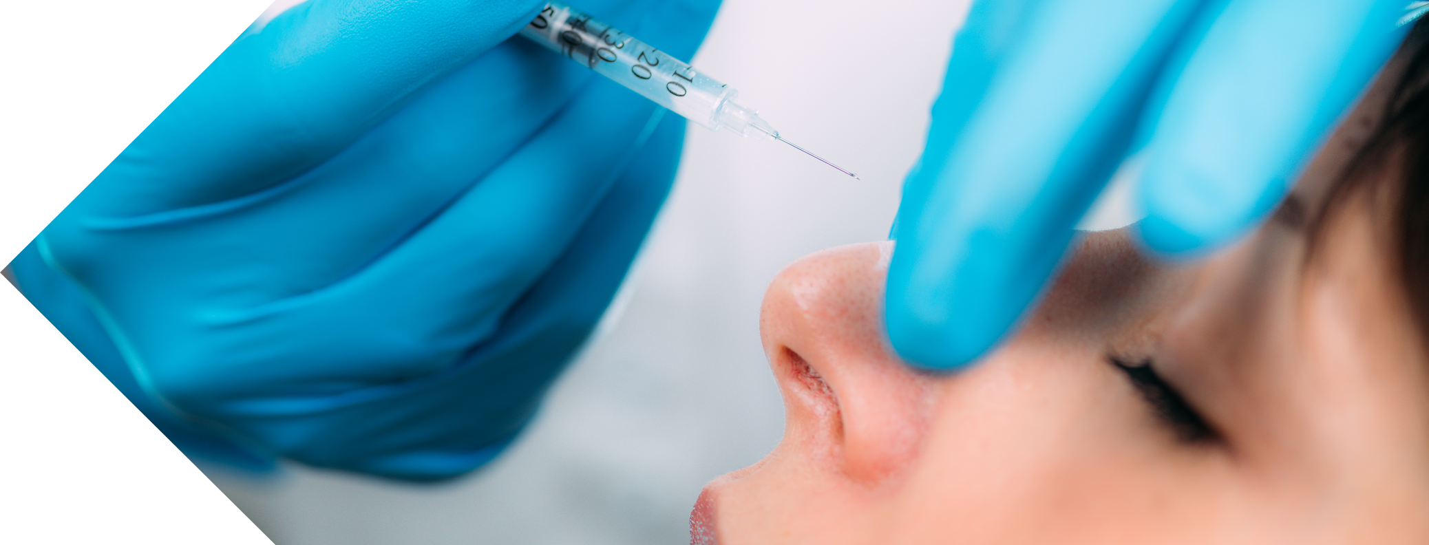 close up of a woman having nose tip treatment