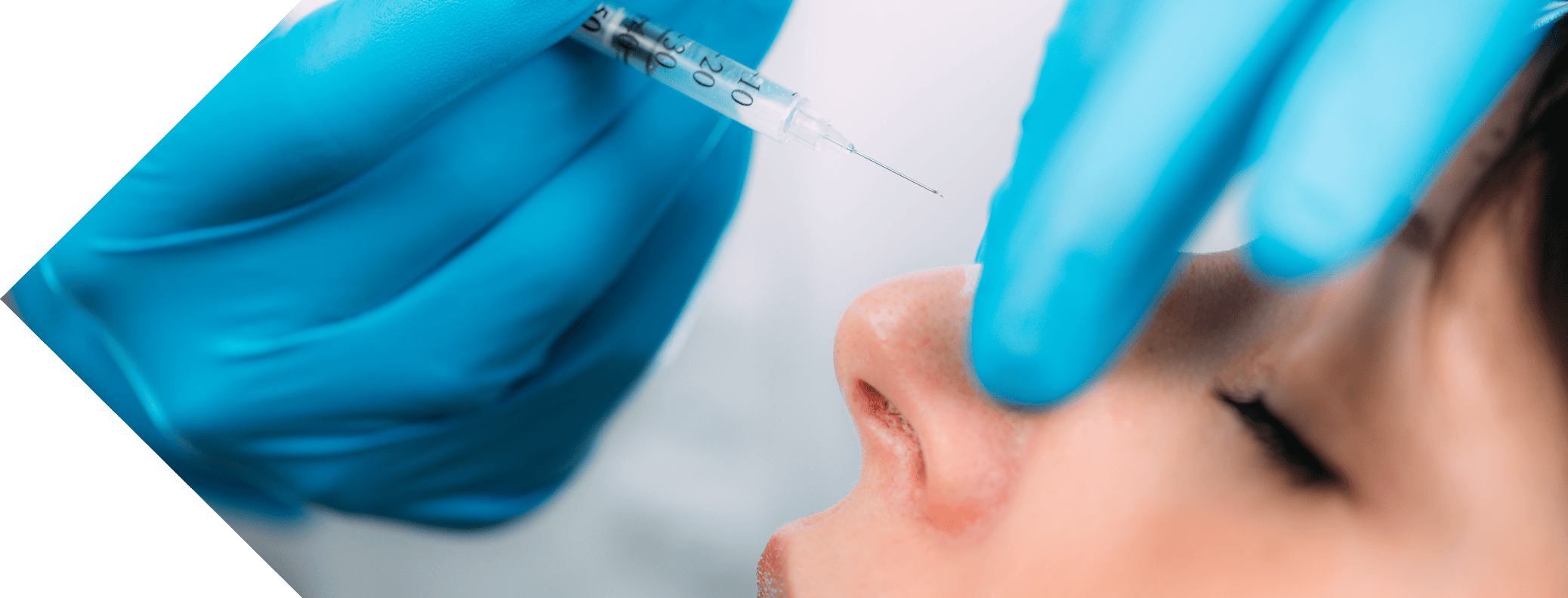 close up of a woman having nose tip treatment