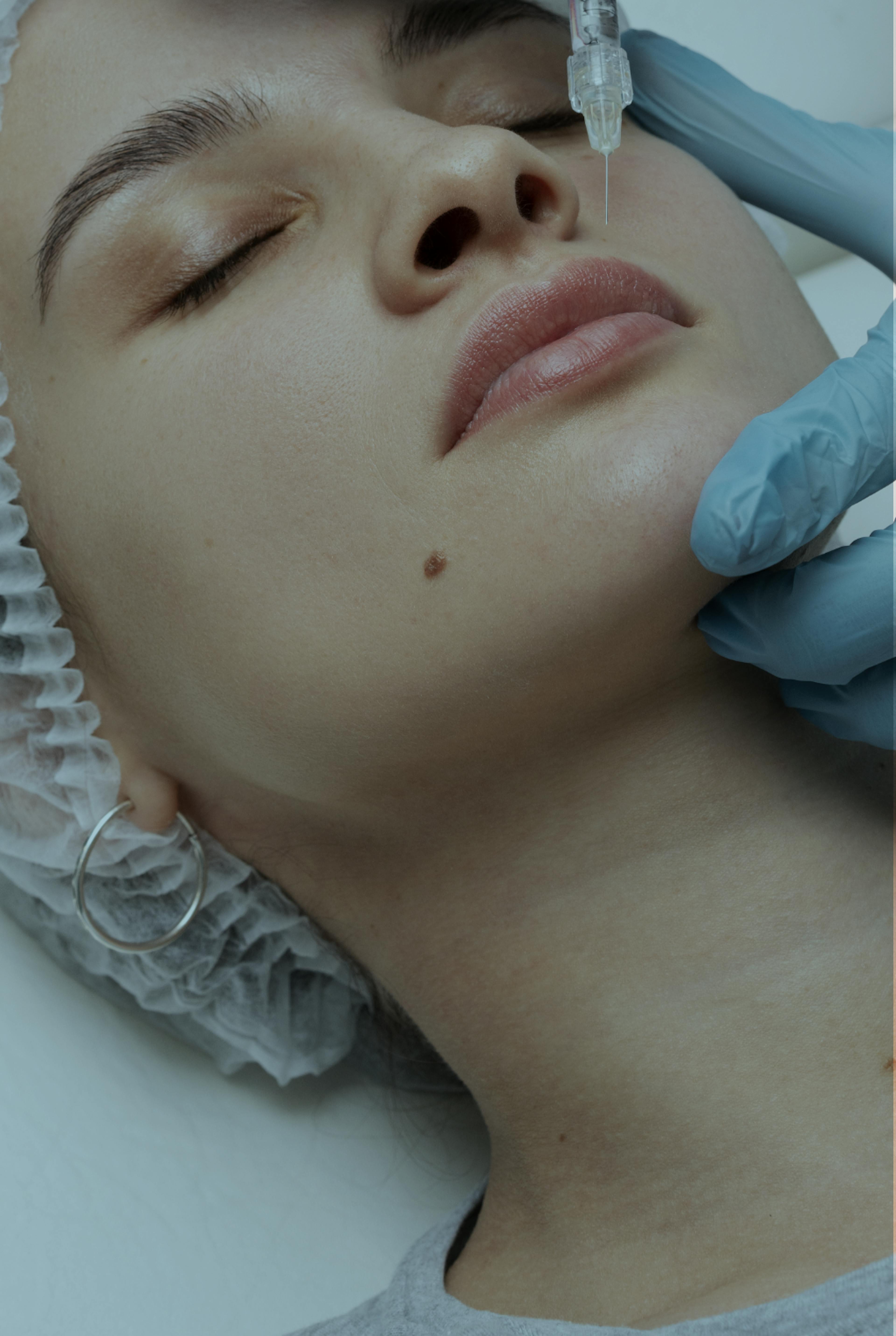 woman having lip filler treatment