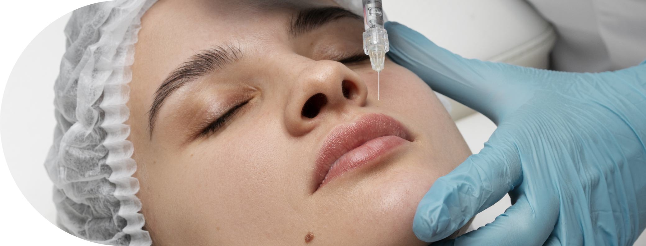 woman having lip filler treatment
