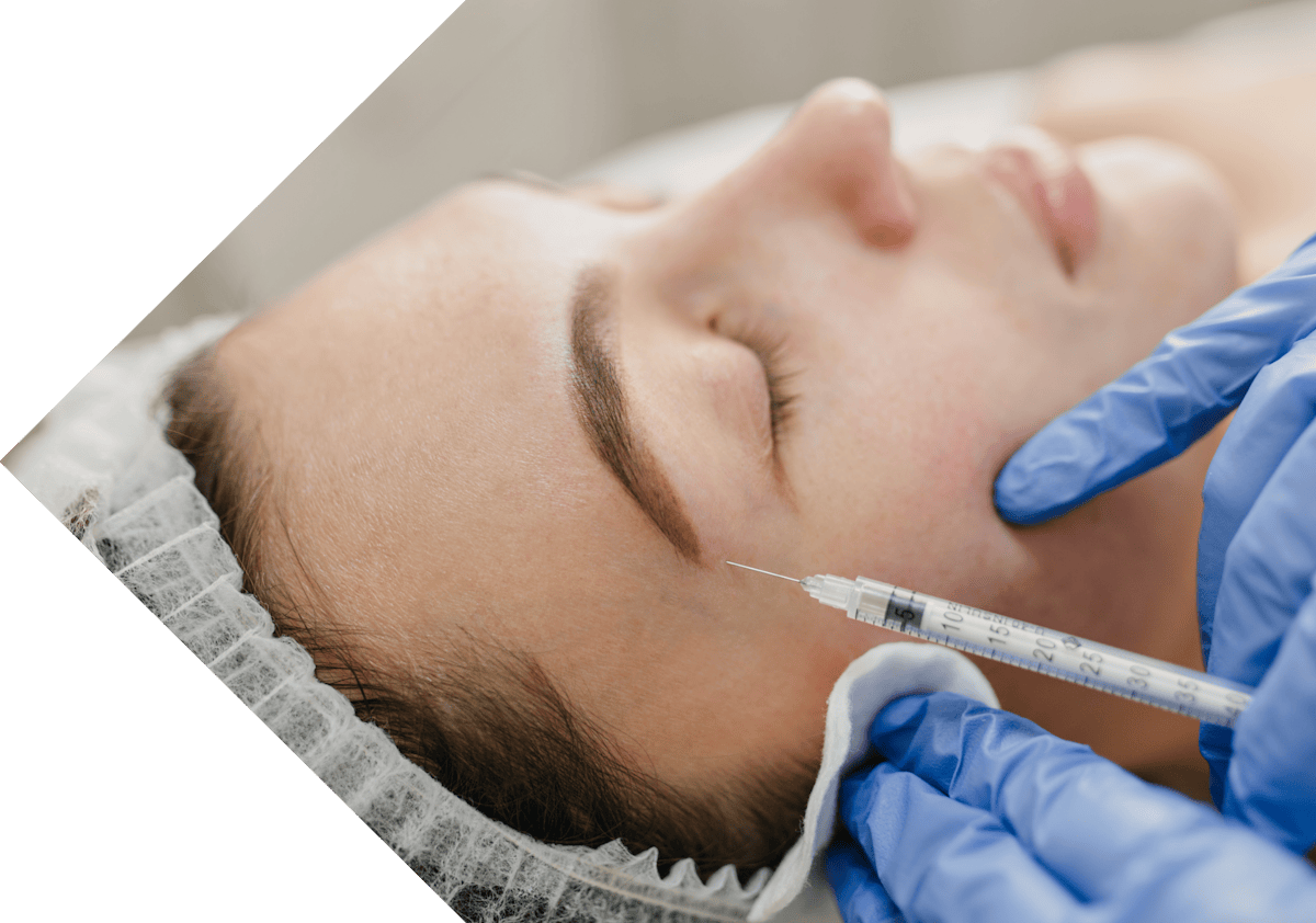 woman having temple filler treatment