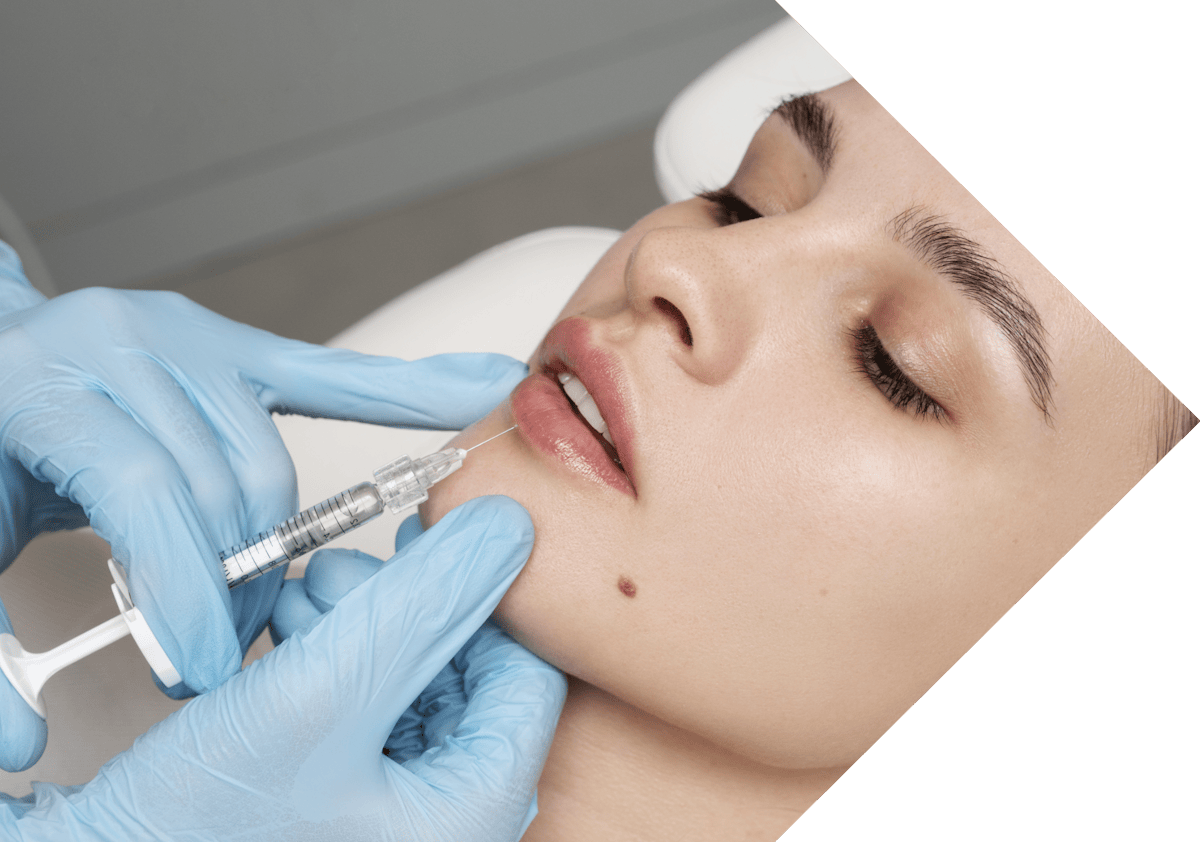 young woman having lip filler treatment