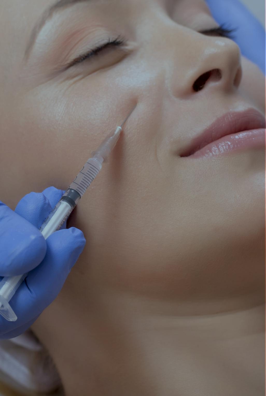 woman having cheek filler treatment