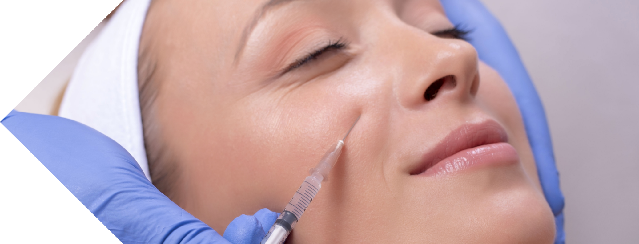 cheek filler treatment being performed