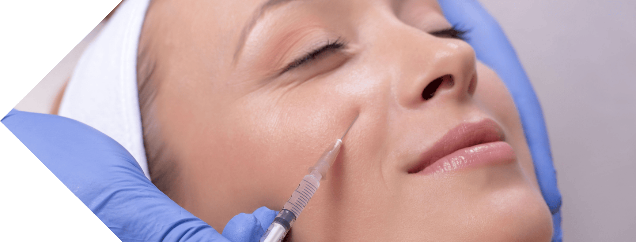 cheek filler treatment being performed