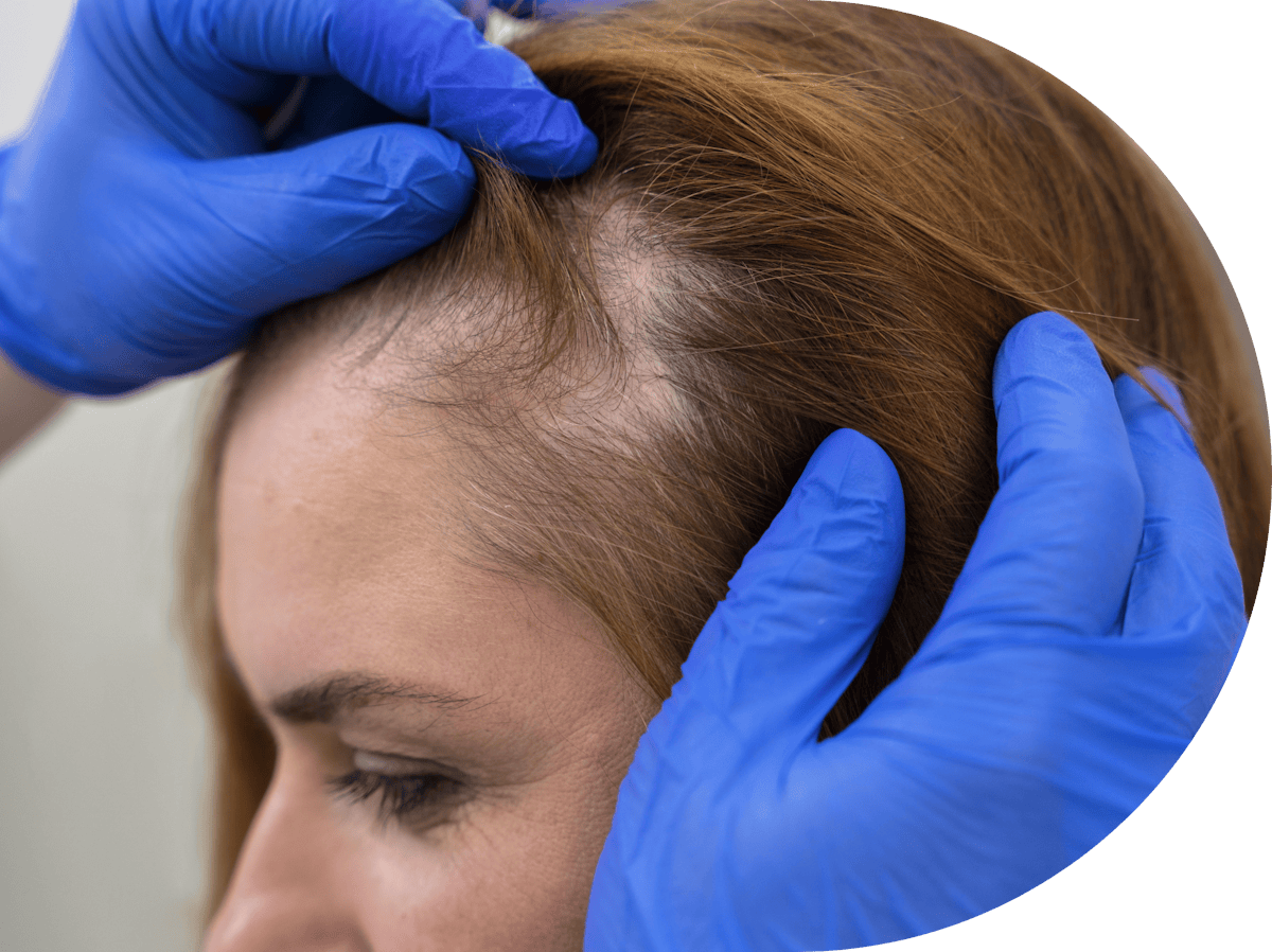 Woman having her head checked for a Pilar Cyst