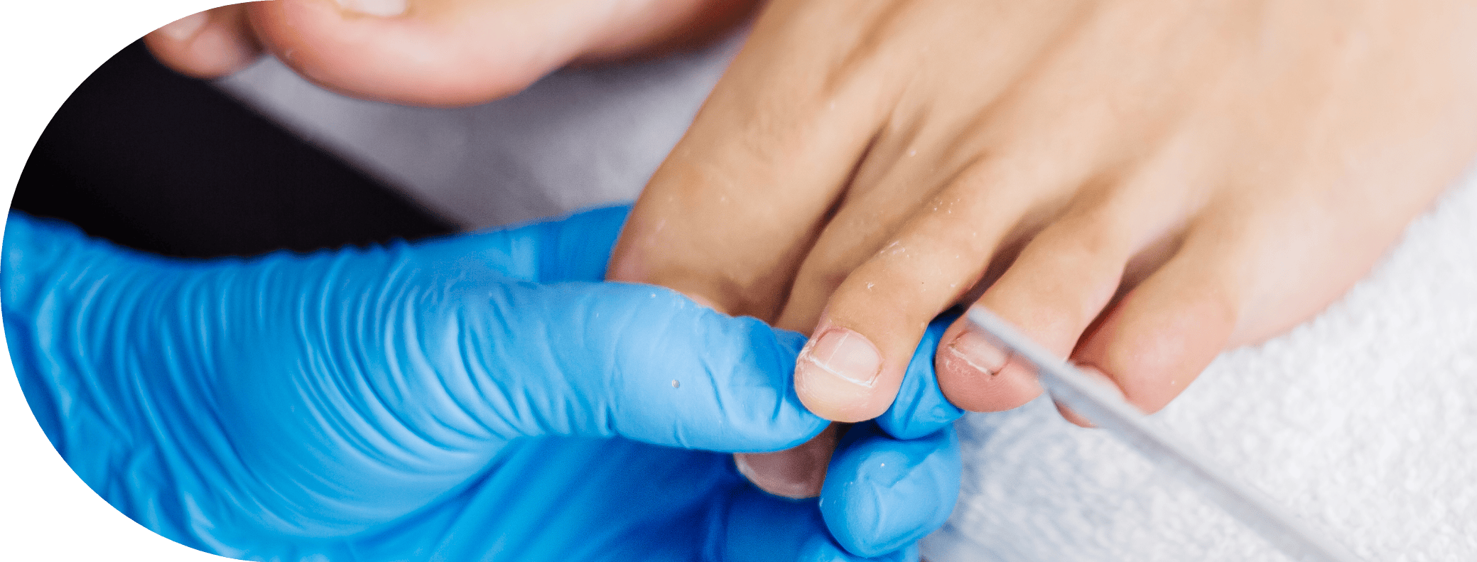 A patient having warts removed from their feet