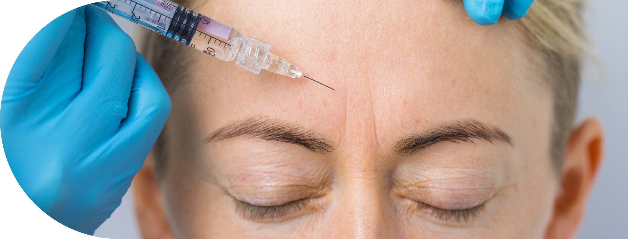 woman having anti wrinkle injection treatment to the forehead