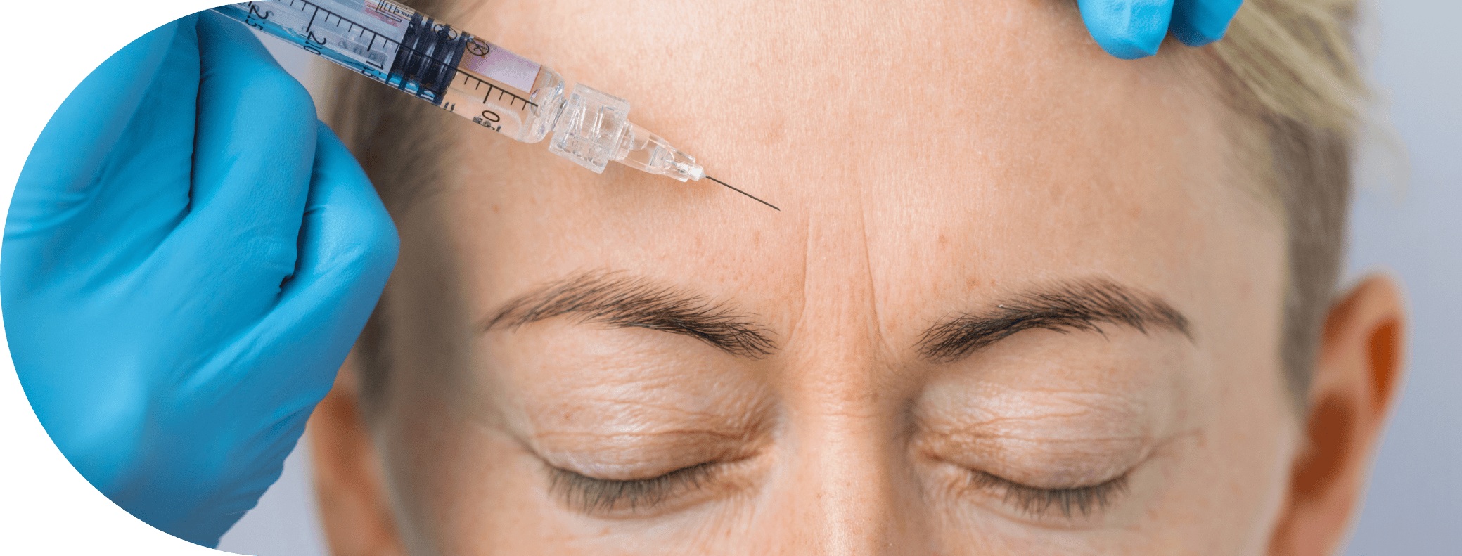 woman having anti wrinkle injection treatment to the forehead