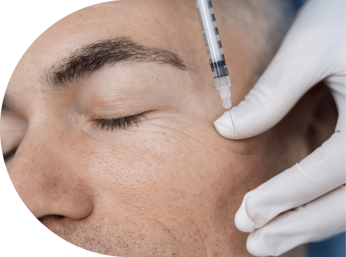 man having anti wrinkle injection treatment
