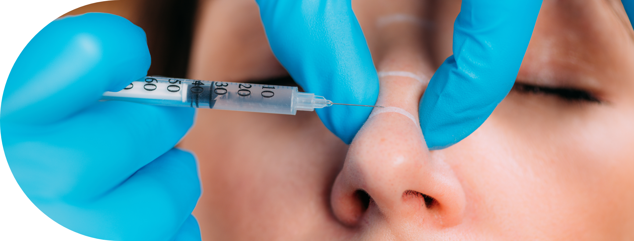 woman having bunny lines treatment on her nose