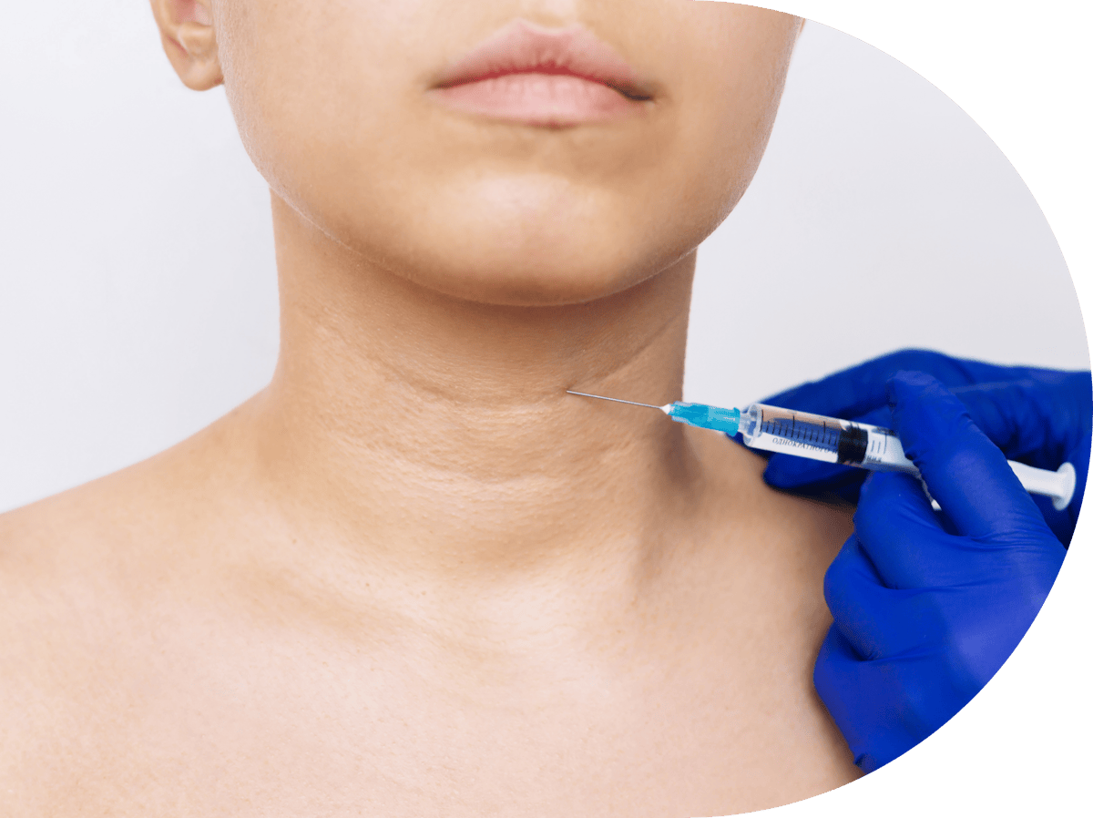 Nefertiti neck lift treatment being performed