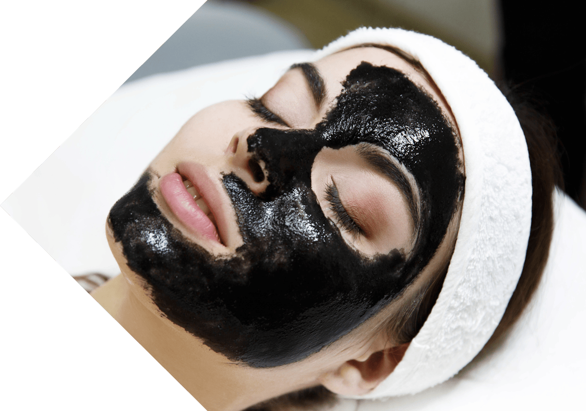 Peel treatment being performed