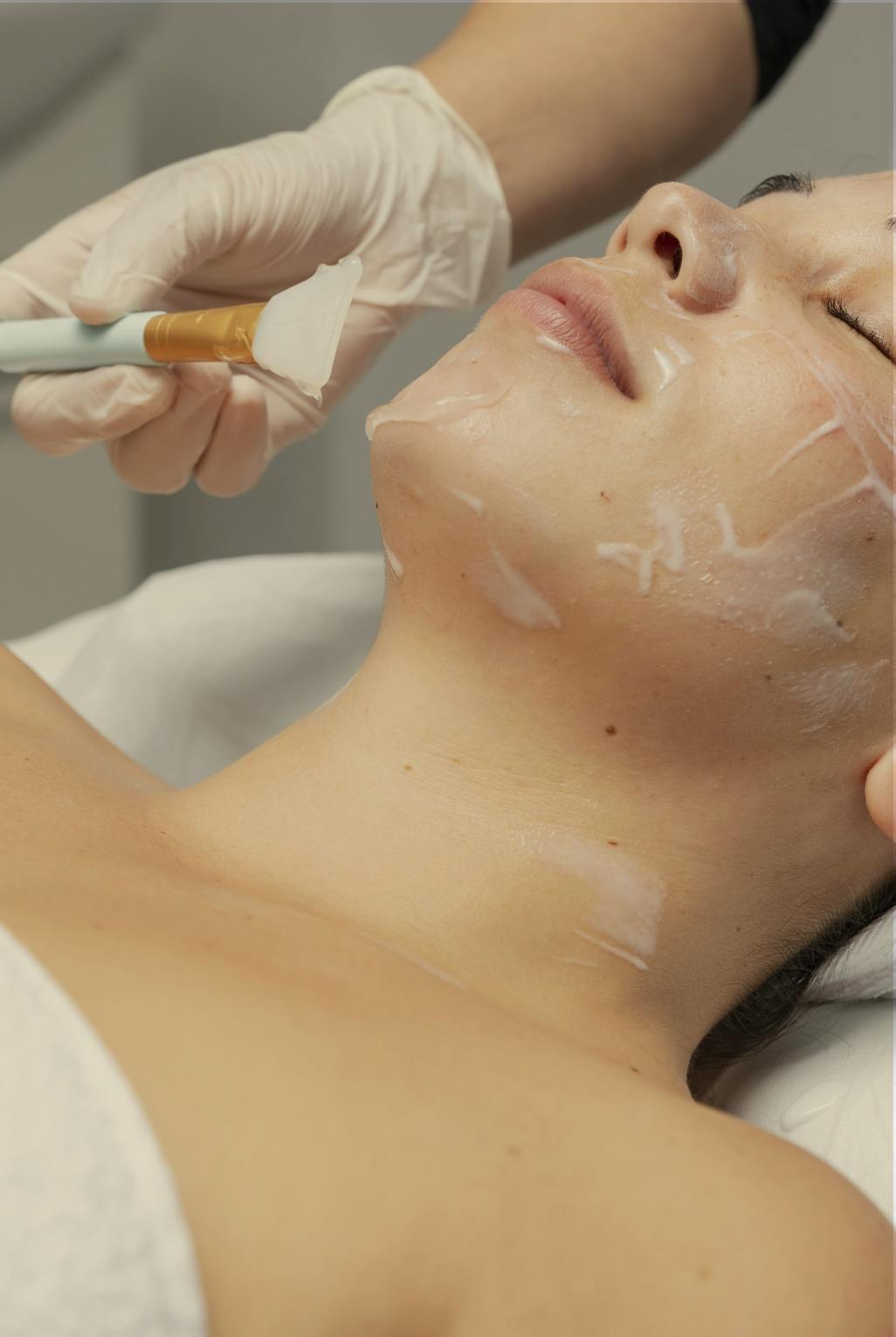 woman having Cosmelan peel treatment