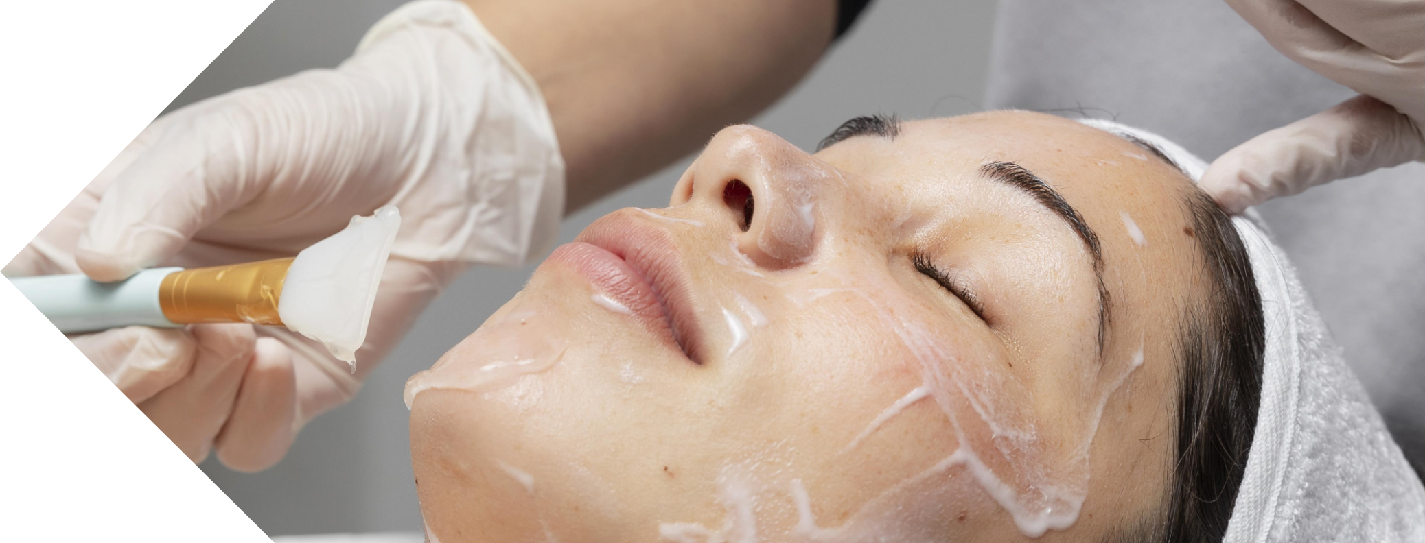 Cosmelan peel treatment being performed