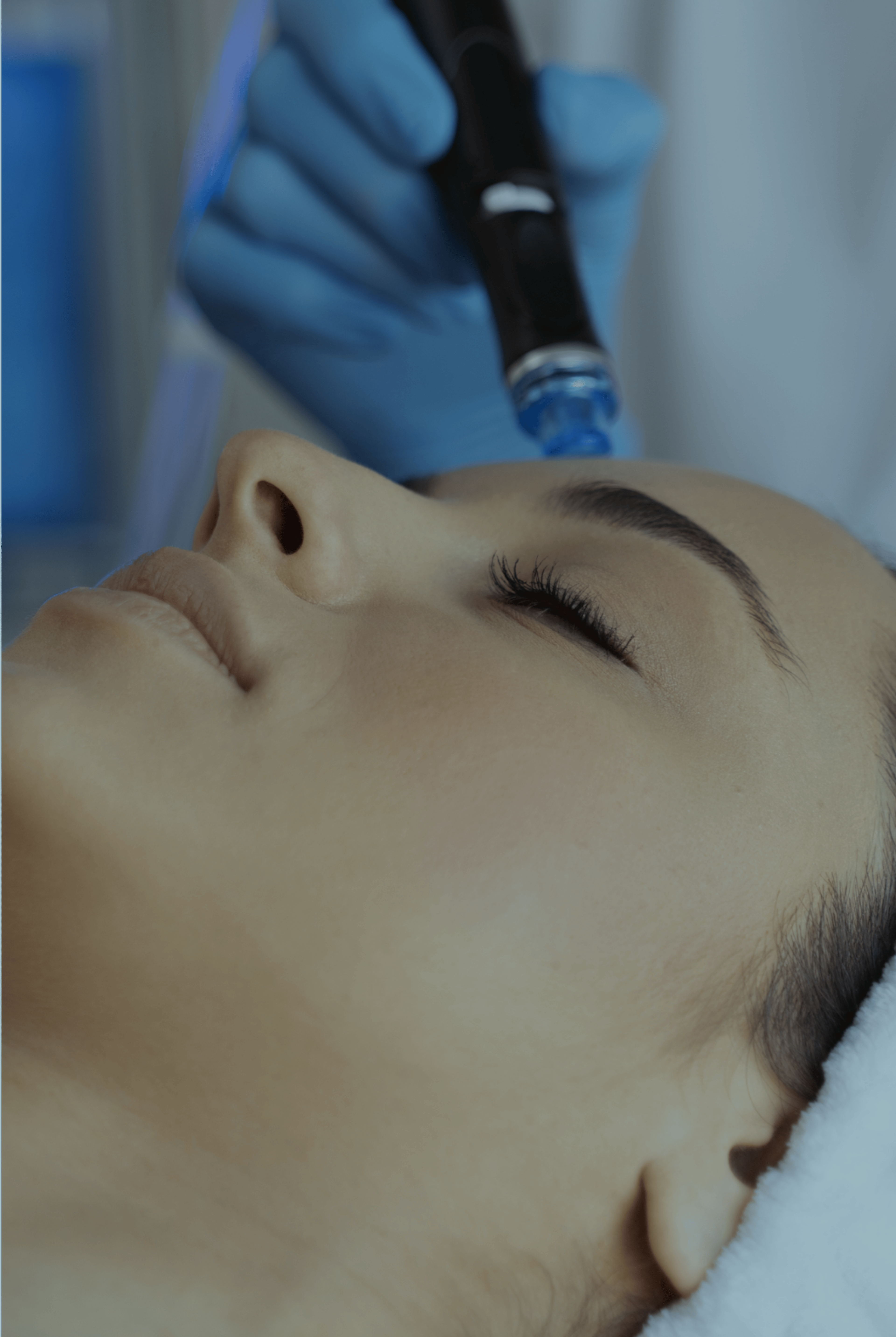woman having cryopen treatment