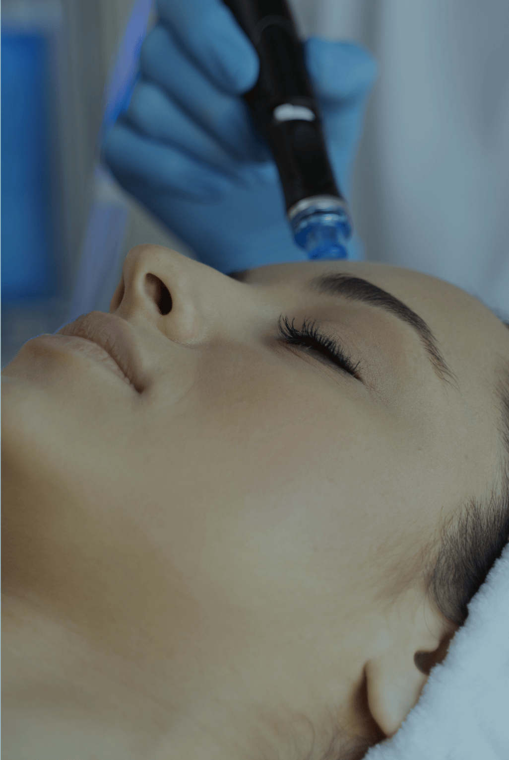 woman having cryopen treatment