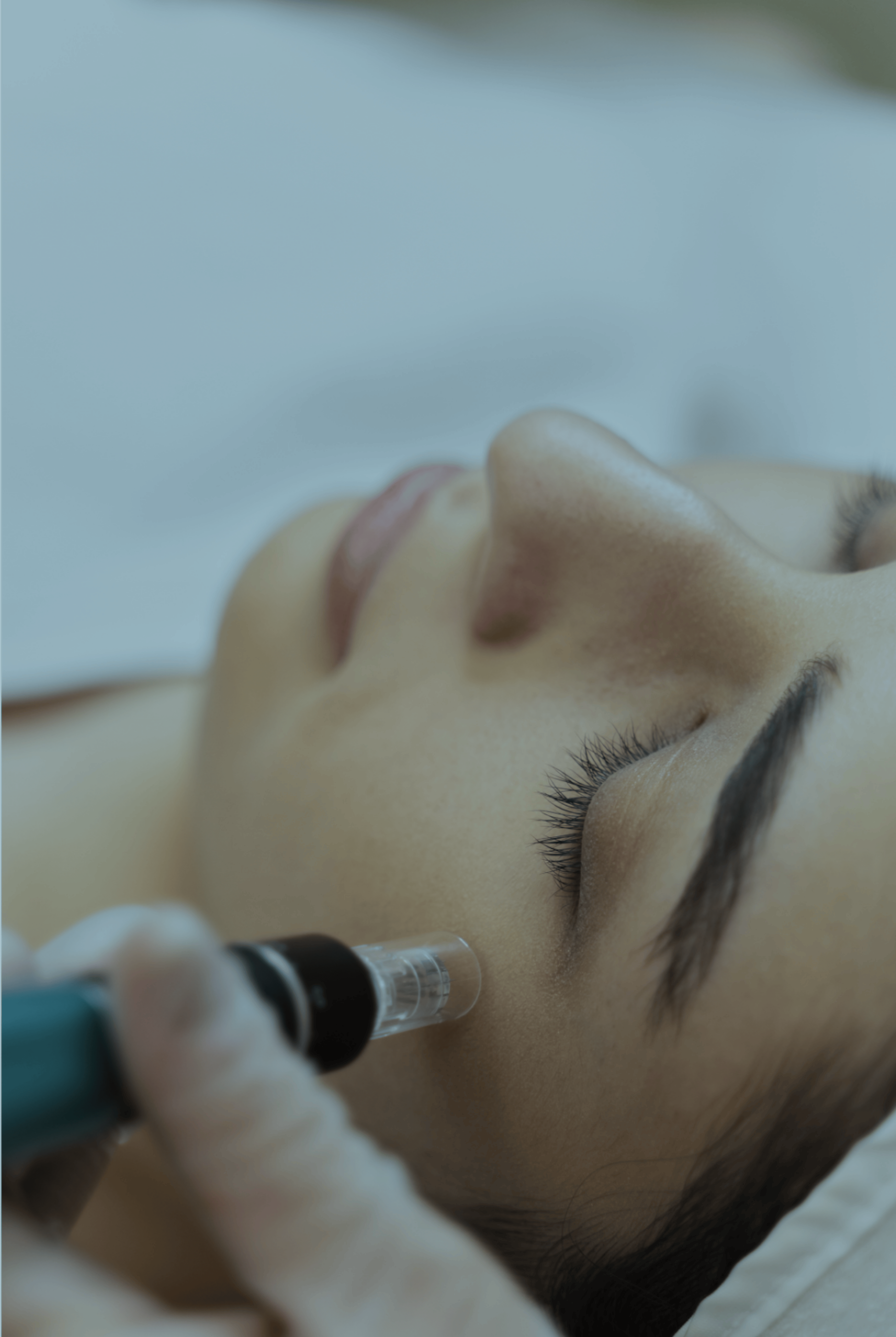 Girl having micro needling treatment to her face