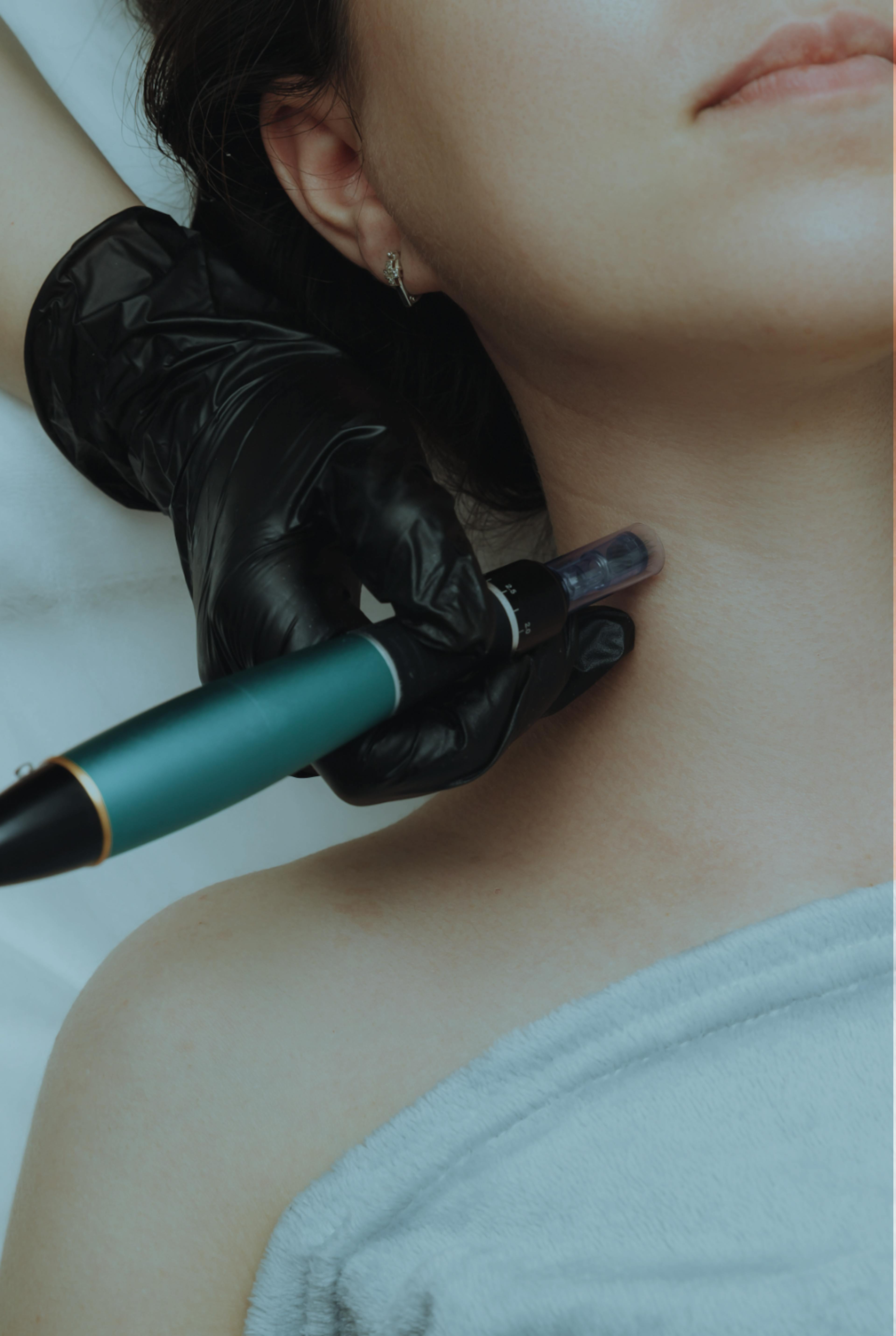 girl having micro needling treatment on her neck