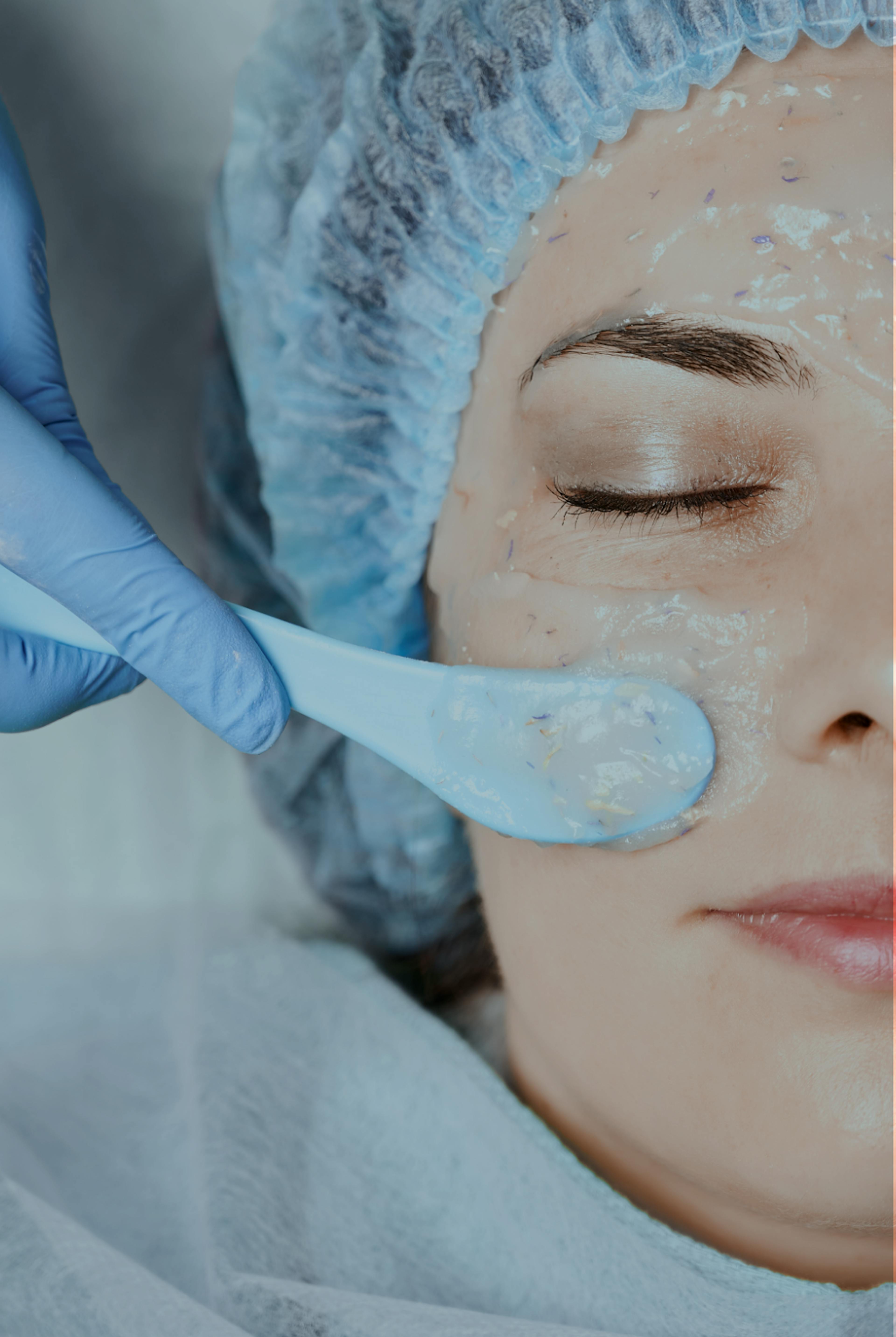 woman having obagi blue radiance treatment