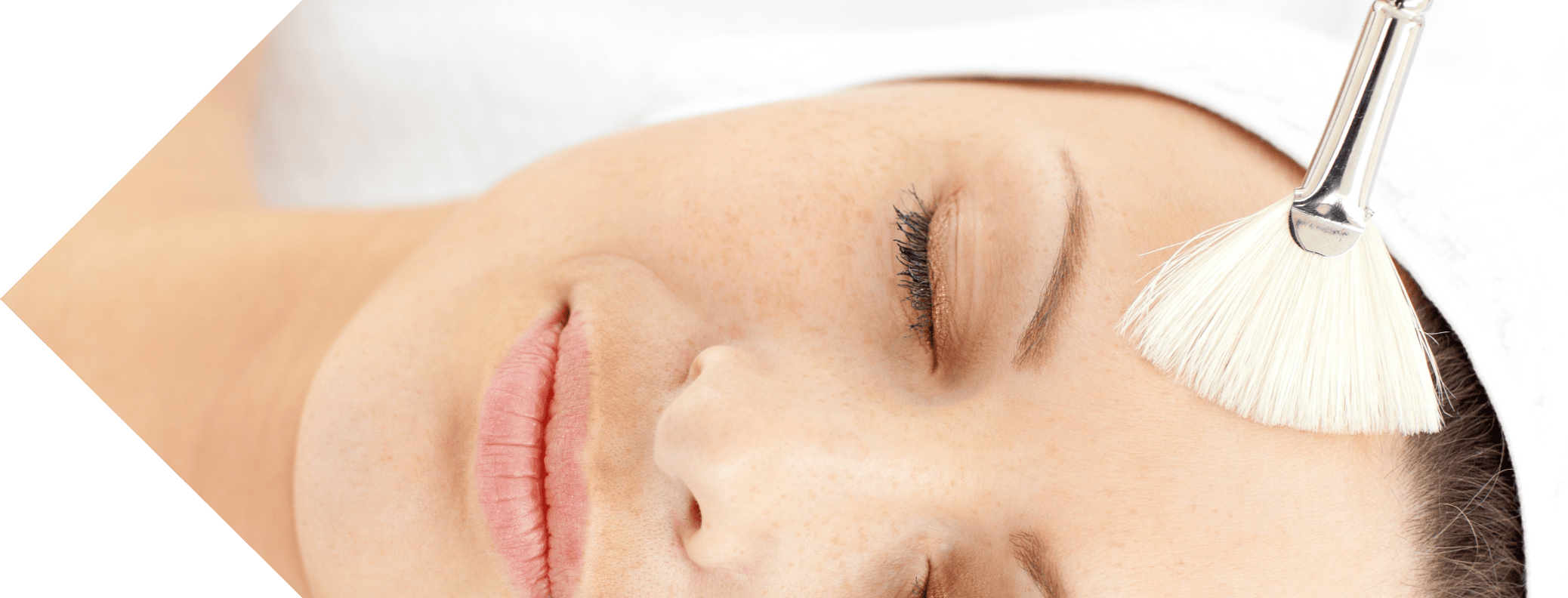 dermamelan peel being performed