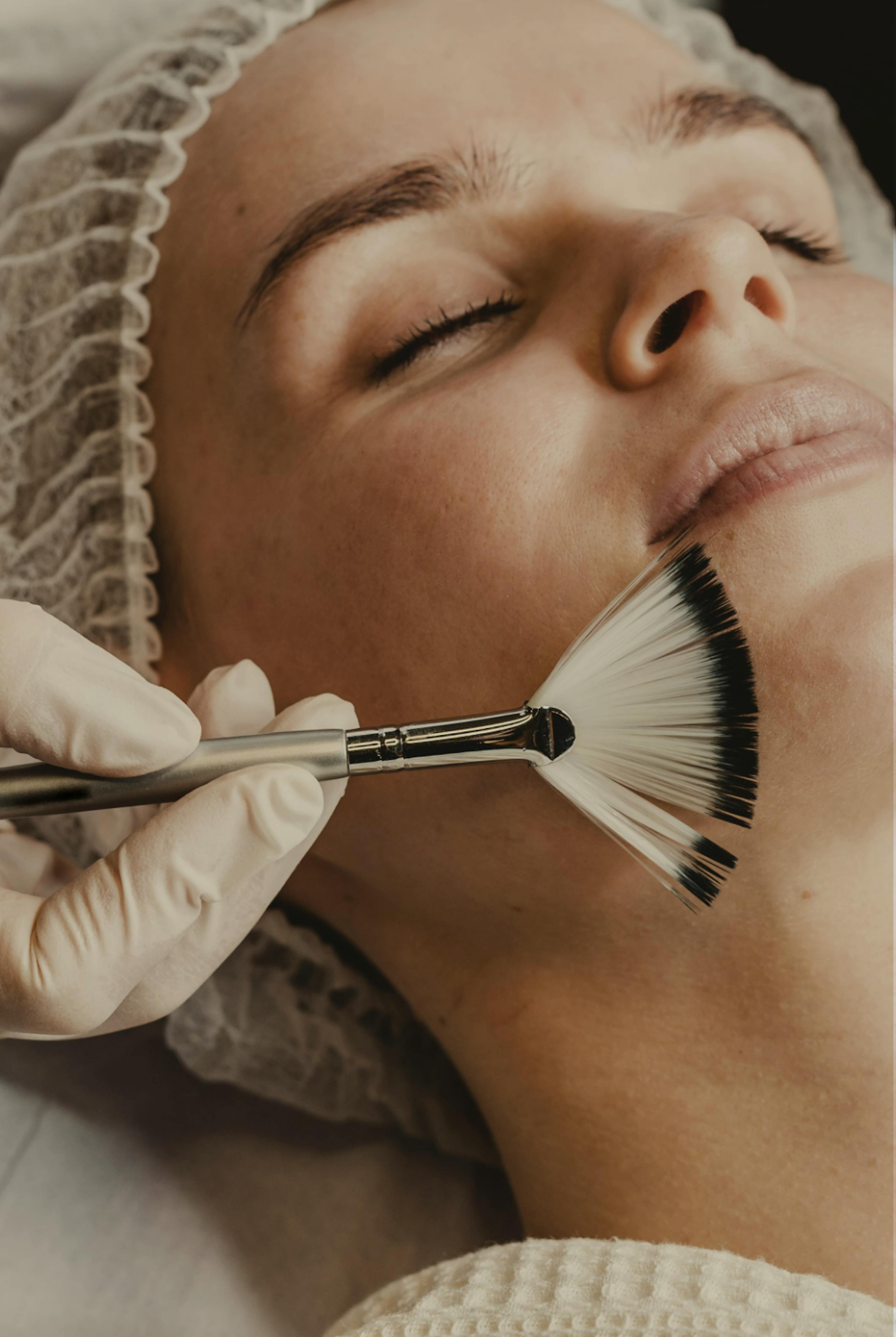 a woman having mesopeel treatment