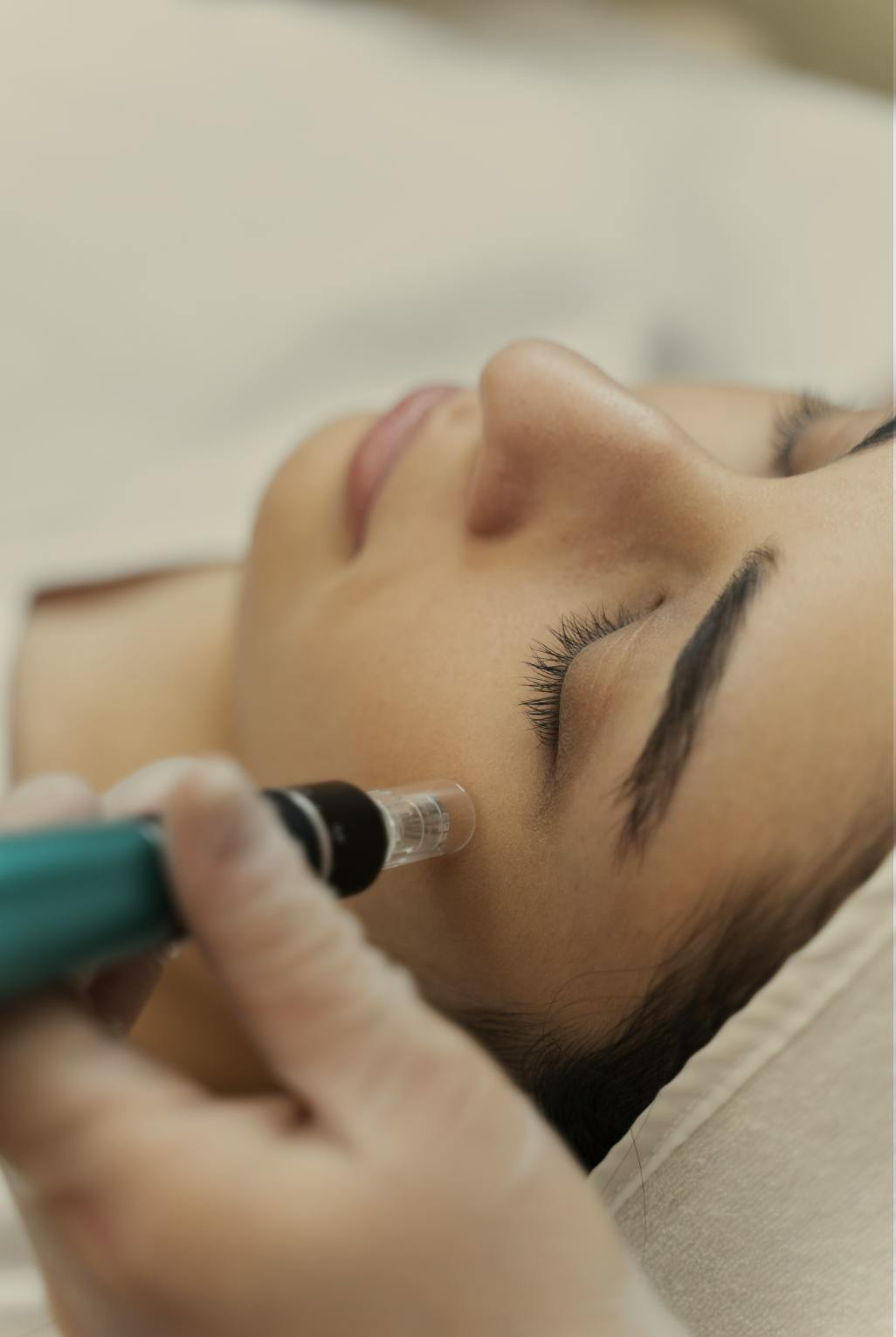 close up of a girl having micro needling treatment
