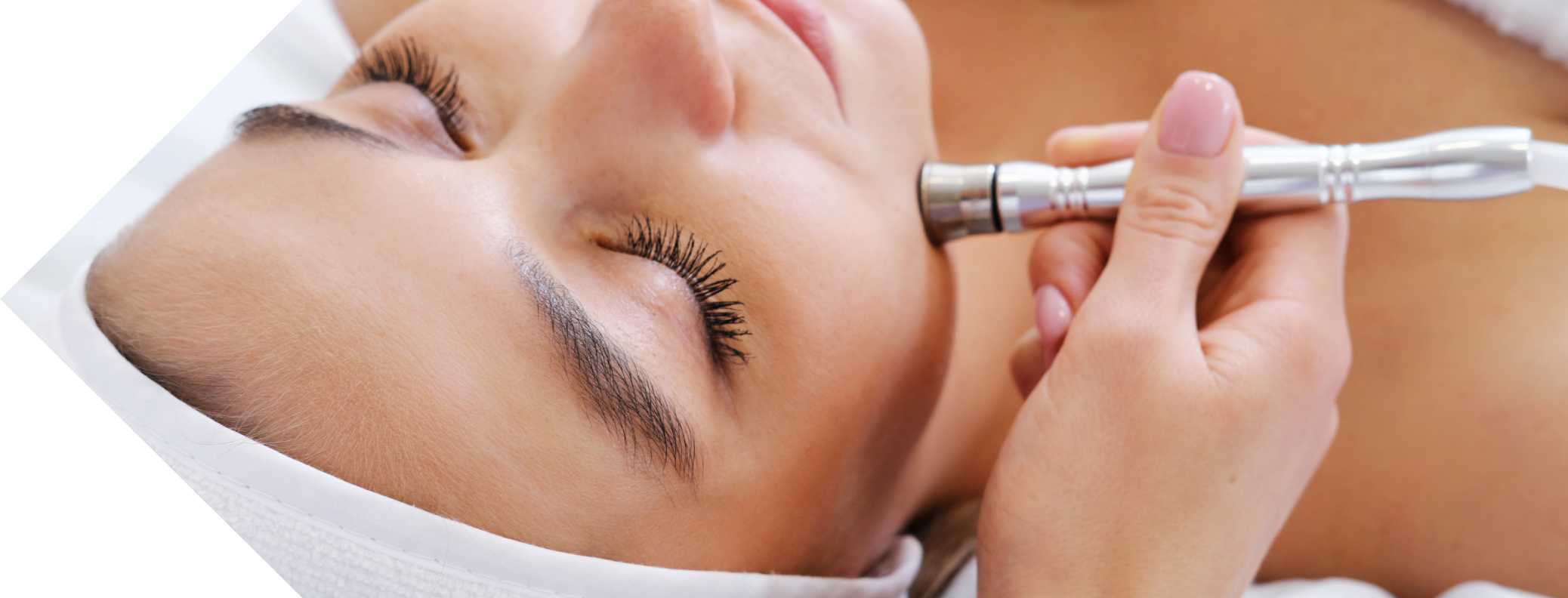 woman having full face micro needling treatment
