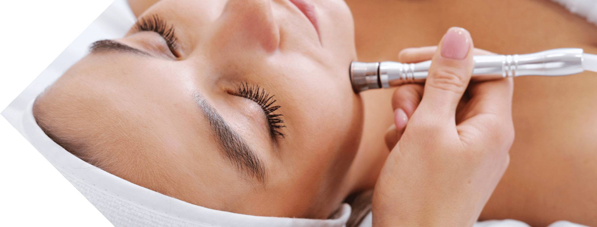 woman having full face micro needling treatment