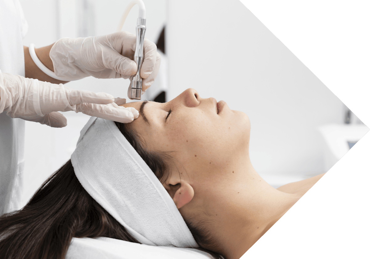 young woman having micro needling treatment