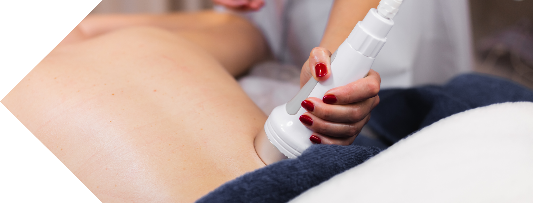 patient having diathermy treatment