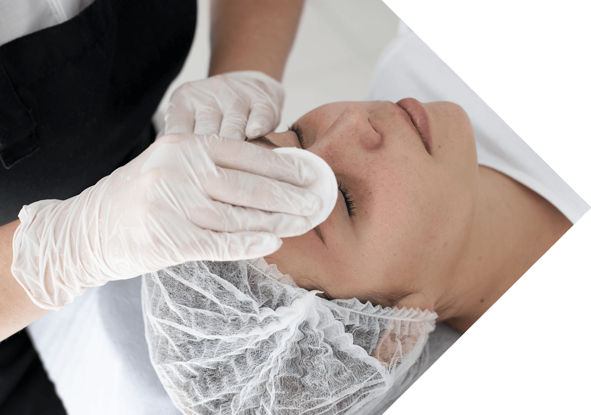 woman having eye skin tag treatment