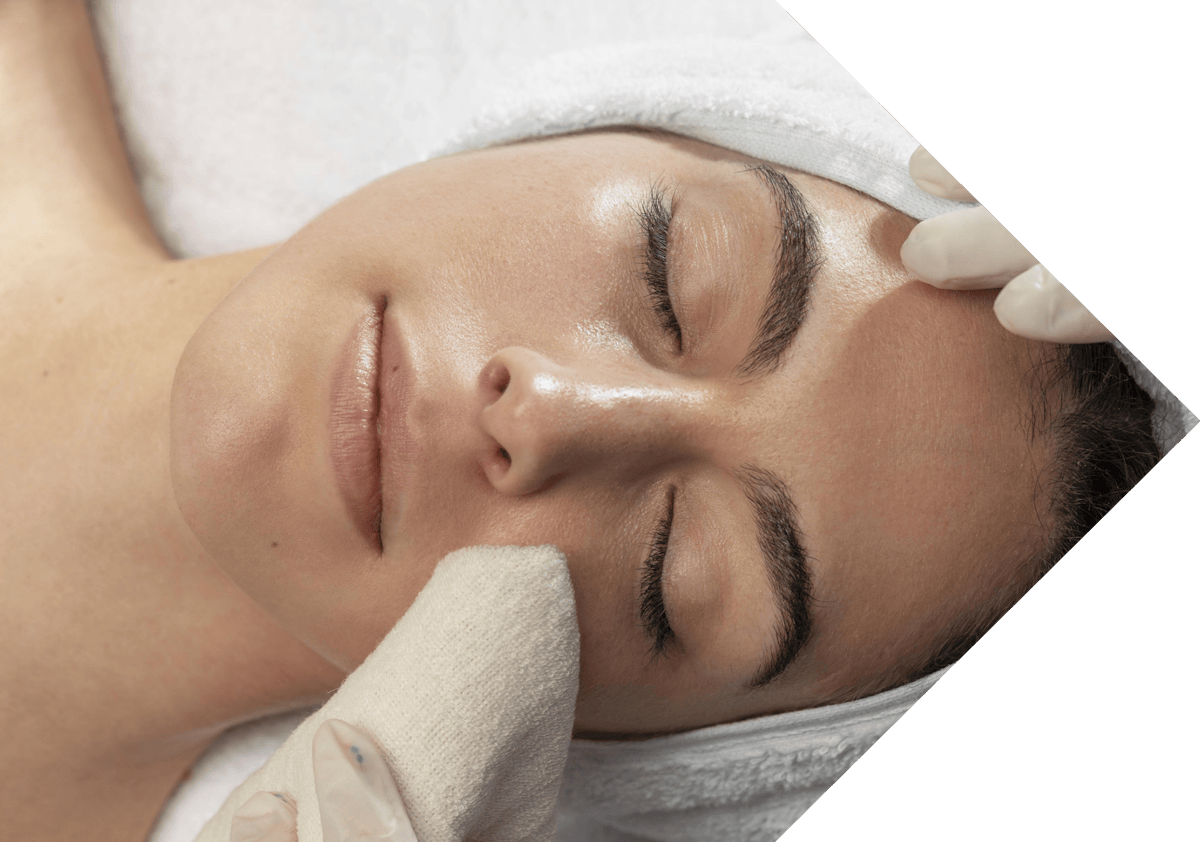 woman having milia treatment