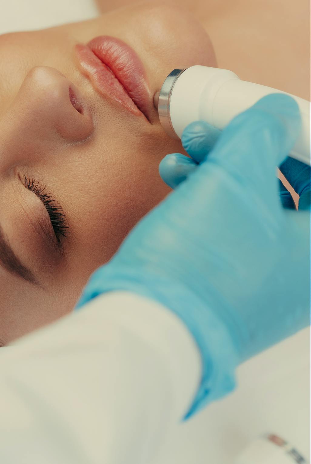 cryopen treatment being performed